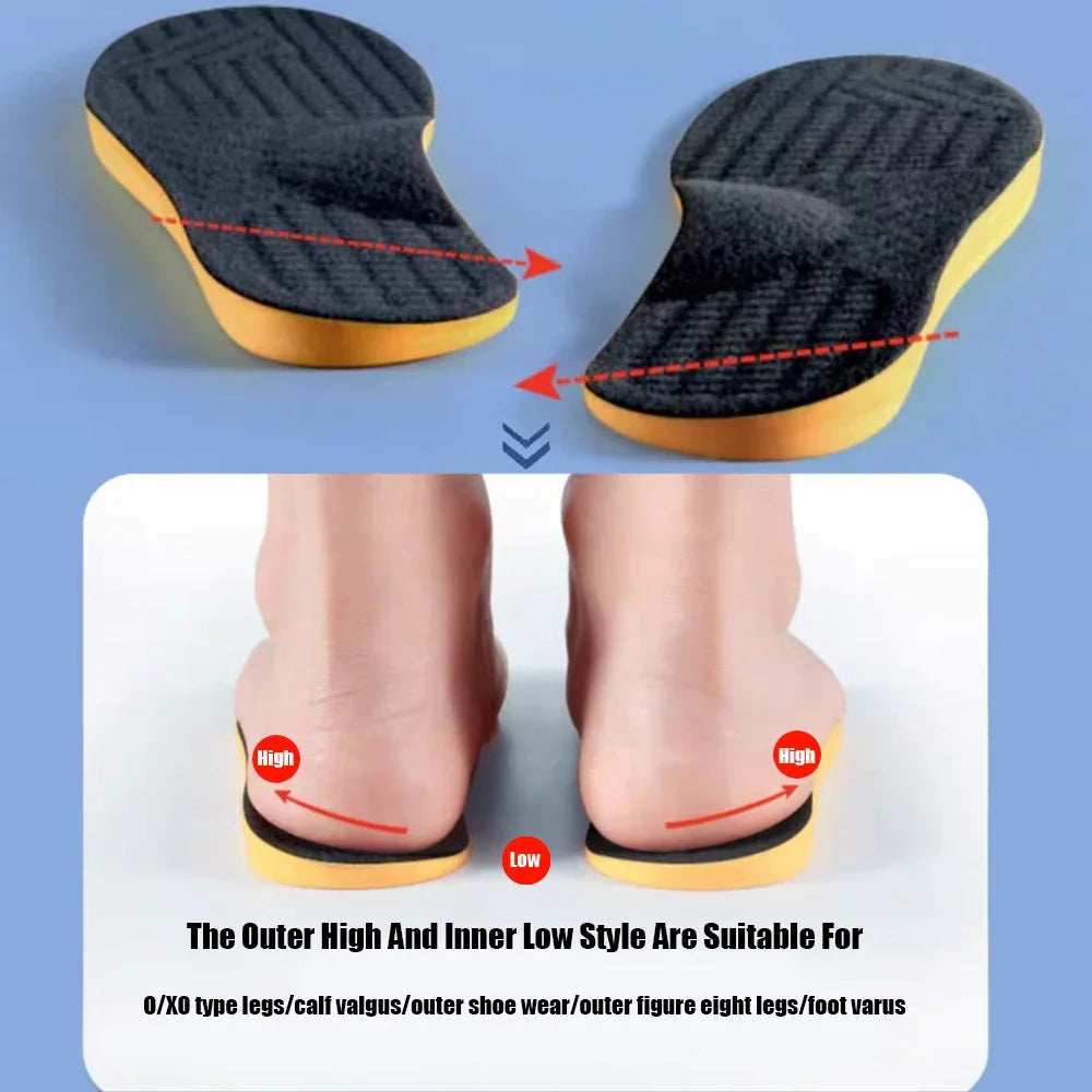 Flat Foot Orthopedic Insoles for Men Women Shoes Arch Support Insoles for Children X/O Type Legs Knee Varus Correction Shoe Pads